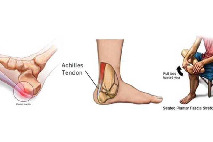 Tips to help heal the heel