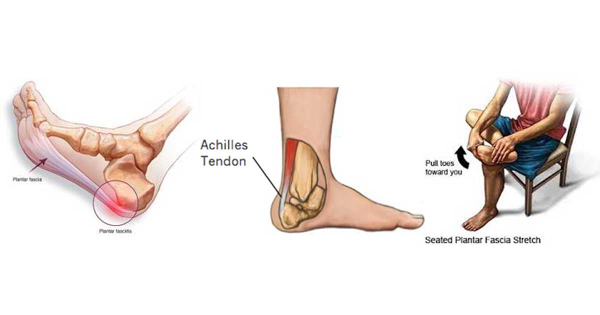 Tips to help heal the heel