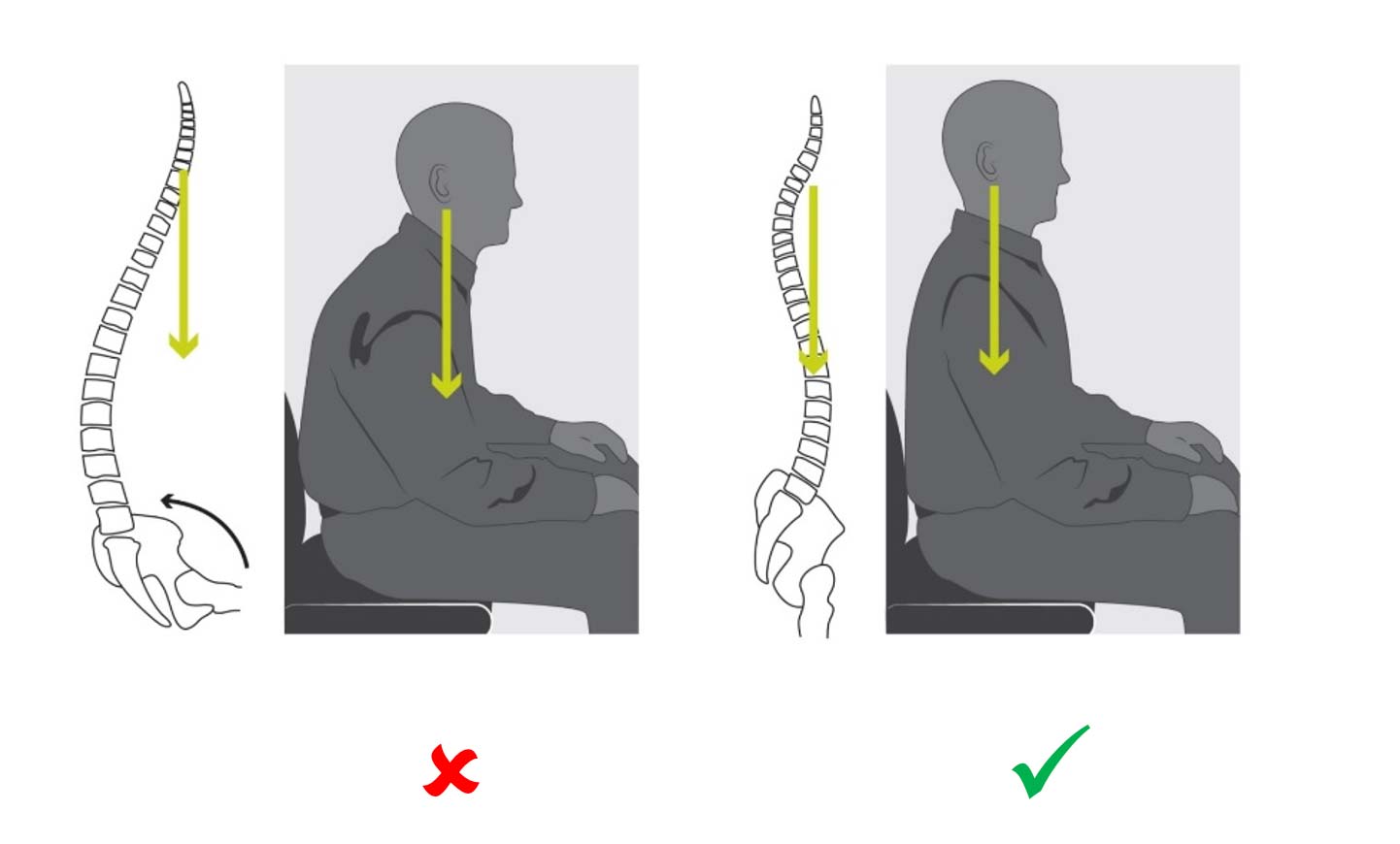 Best Exercises to Correct a Hunchback aka Dowager's Hump - Ergoworks  Physiotherapy